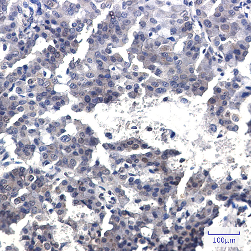 CREB Regulated Transcription Coactivator 2 Rabbit mAb